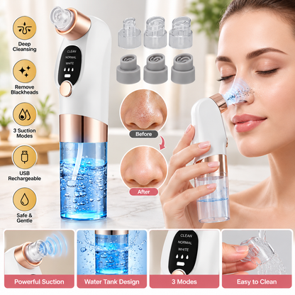 Electric Acne & Blackhead Remover Facial Skin Cleaning Tool
