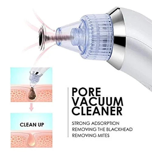 4 In 1 Pore Cleansing Detox Tool